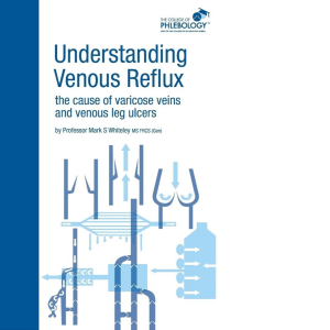Understanding Venous Reflux the Cause of Varicose Veins and Venous Leg Ulcers: Varicose veins and venous leg ulcers (College of Phlebology) Paperback – Illustrated, 26 Sept. 2011