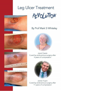 Leg Ulcer Treatment Revolution Paperback – Illustrated, November 5, 2018